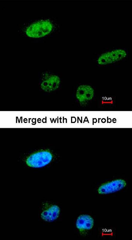 Anti-RASSF1 Antibody Anti-RASSF1 Antibody