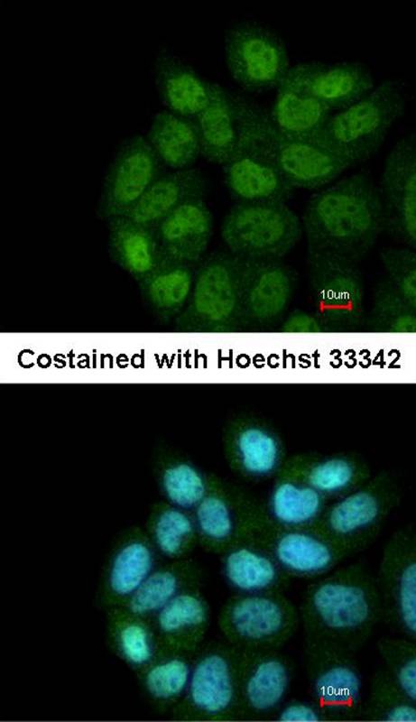Anti-LRRC43 Antibody Anti-LRRC43 Antibody
