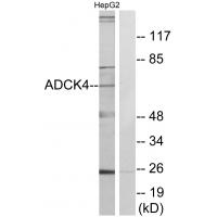Anti-ADCK4 Antibody