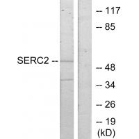 Anti-SERC2 Antibody