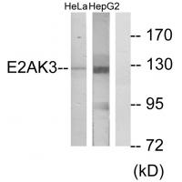 Anti-E2AK3 Antibody