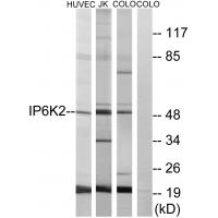 Anti-IP6K2 Antibody
