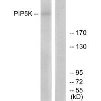 Anti-PIP5K Antibody