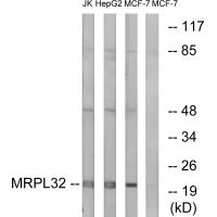 Anti-MRPL32 Antibody