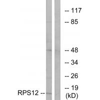 Anti-RPS12 Antibody