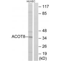 Anti-ACOT8 Antibody