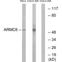 Anti-ARMC6 Antibody