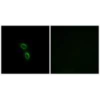 Anti-ARMC6 Antibody Anti-ARMC6 Antibody