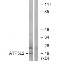 Anti-ATP5L2 Antibody
