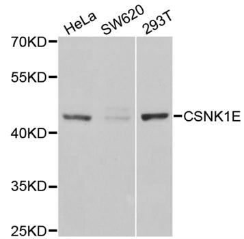 Anti-CSNK1E Antibody