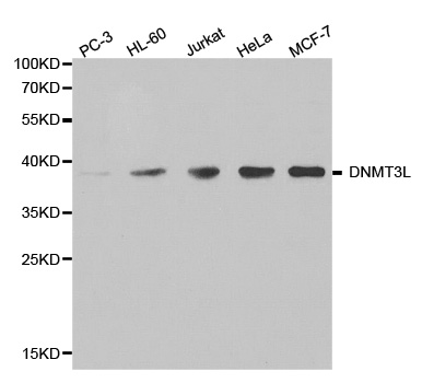 Anti-DNMT3L Antibody