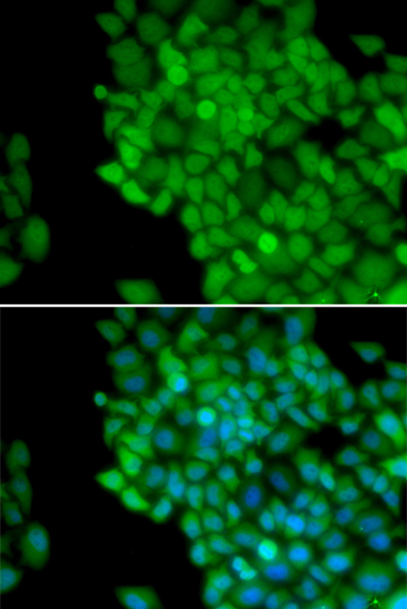 Anti-MAGEA1 Antibody