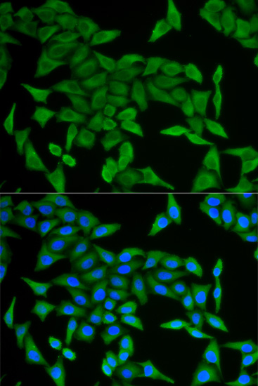 Anti-CRABP2 Antibody Anti-CRABP2 Antibody