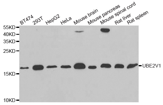 Anti-UBE2V1 Antibody