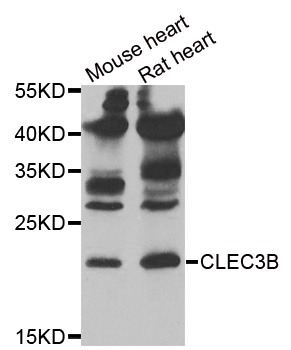 Anti-CLEC3B Antibody