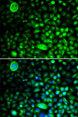 Anti-CACNG2 Antibody