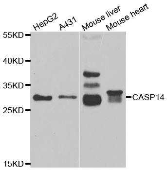 Anti-CASP14 Antibody