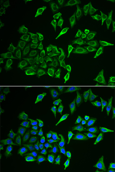 Anti-COX4I1 Antibody Anti-COX4I1 Antibody