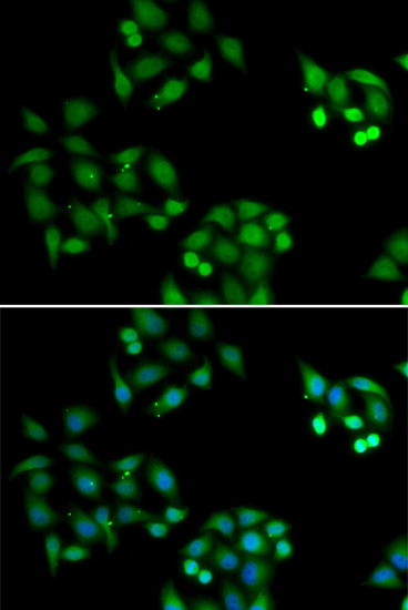 Anti-NSFL1C Antibody Anti-NSFL1C Antibody