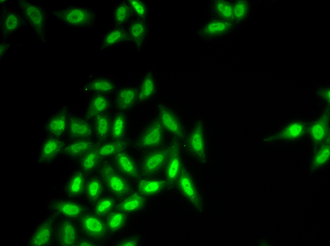 Anti-SETMAR Antibody