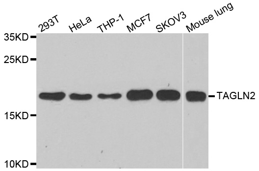 Anti-TAGLN2 Antibody