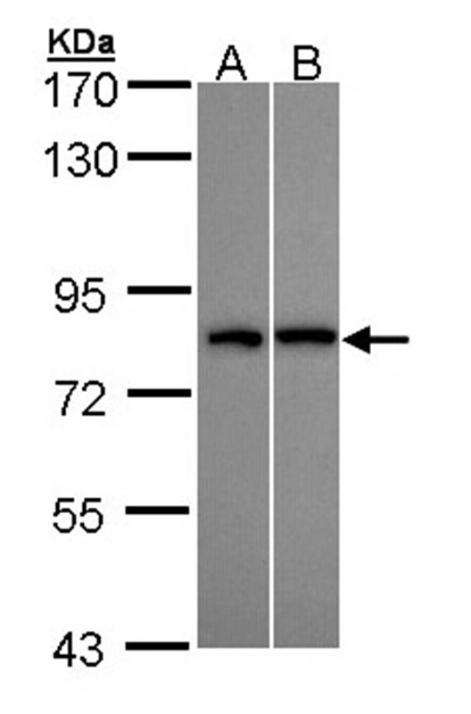 Anti-DDX3Y Antibody