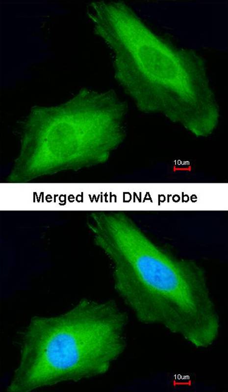 Anti-DDX3Y Antibody Anti-DDX3Y Antibody