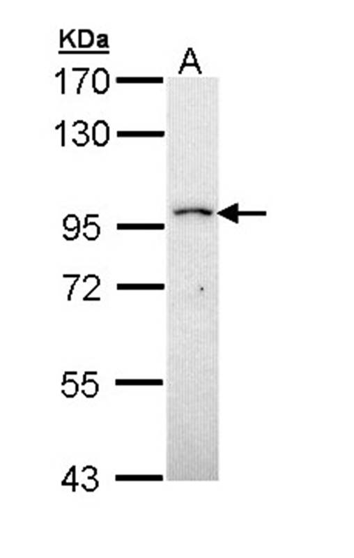 Anti-PRP4K Antibody