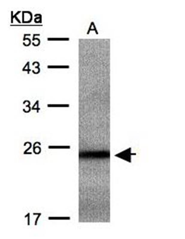 Anti-RAB2B Antibody