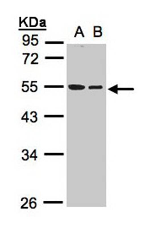 Anti-TUBB1 Antibody