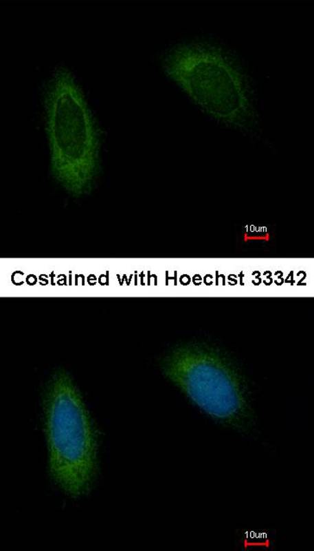 Anti-TRAM1 Antibody Anti-TRAM1 Antibody