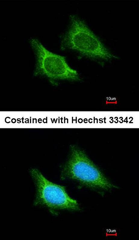Anti-MRPS5 Antibody Anti-MRPS5 Antibody