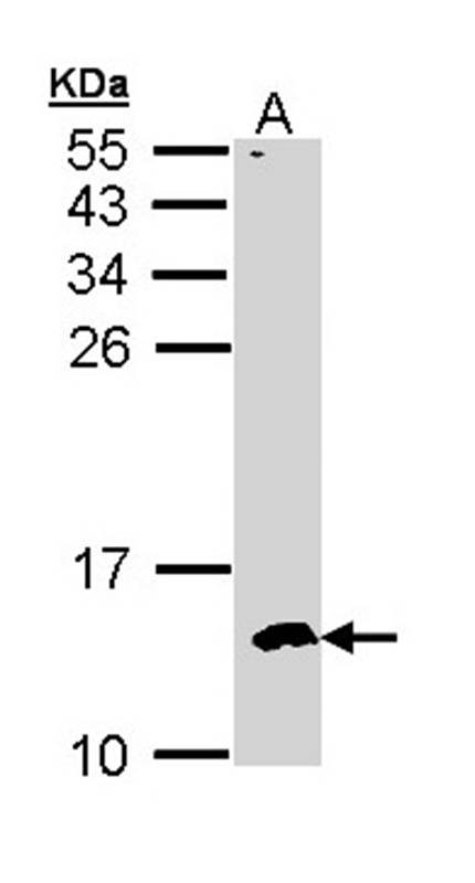 Anti-CKS-2 Antibody