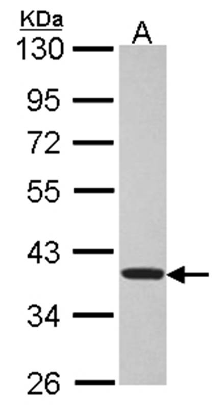 Anti-TSSC1 Antibody