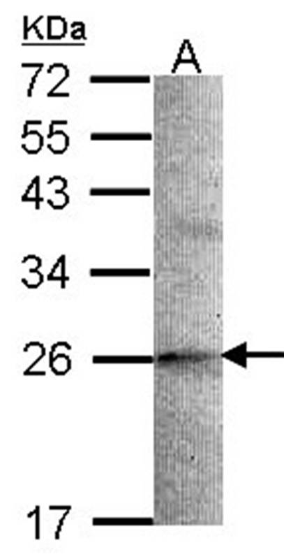 Anti-STMN2 Antibody