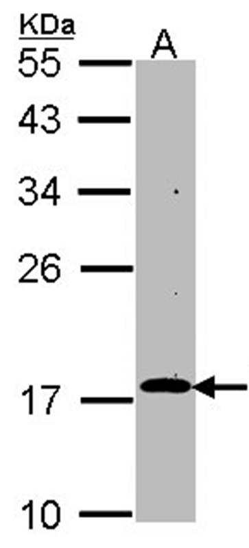 Anti-RGS17 Antibody