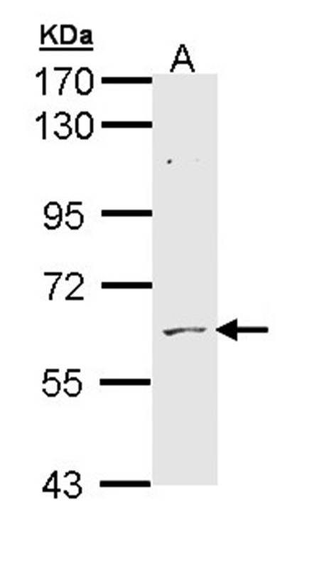 Anti-ADCK1 Antibody