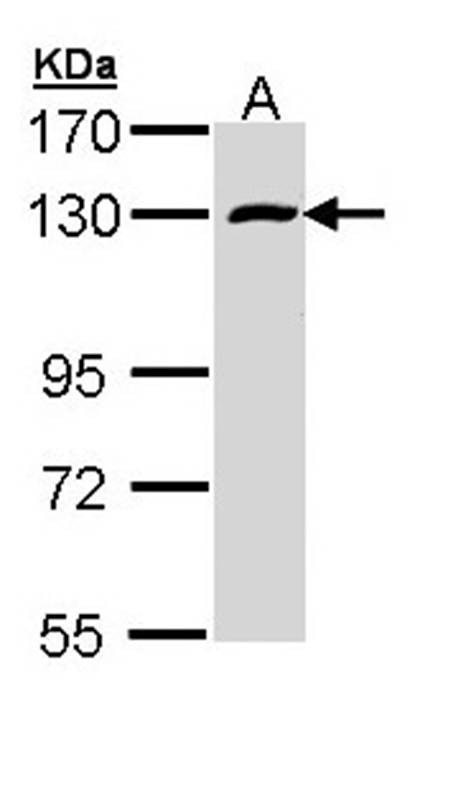 Anti-RBM15 Antibody