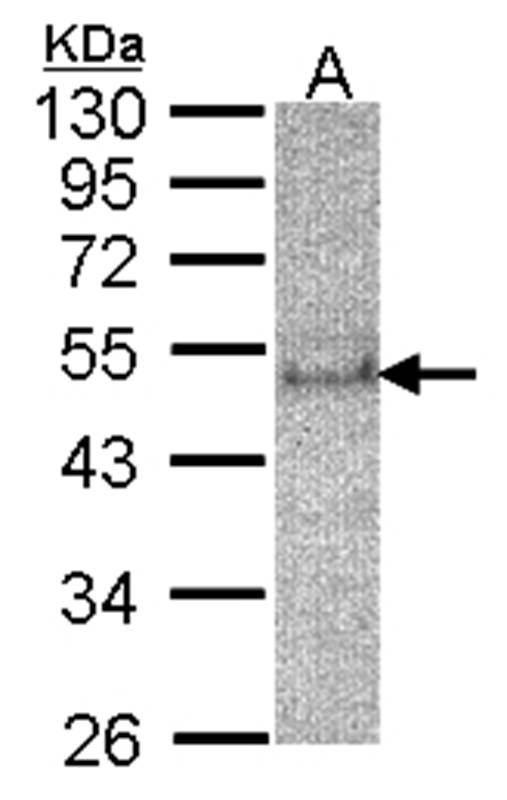 Anti-SOCS4 Antibody