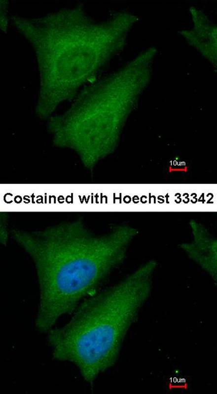Anti-SOCS4 Antibody Anti-SOCS4 Antibody