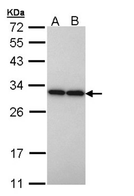 Anti-PGAM2 Antibody