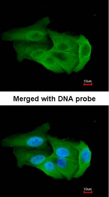 Anti-PGAM2 Antibody Anti-PGAM2 Antibody