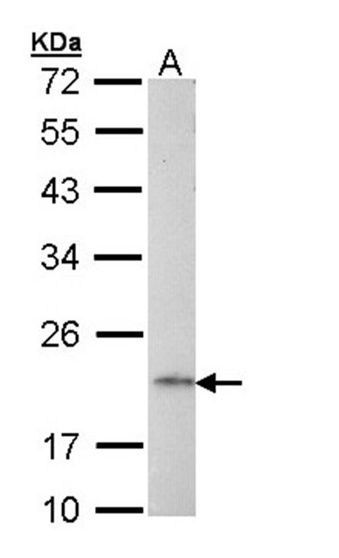 Anti-AP1S2 Antibody