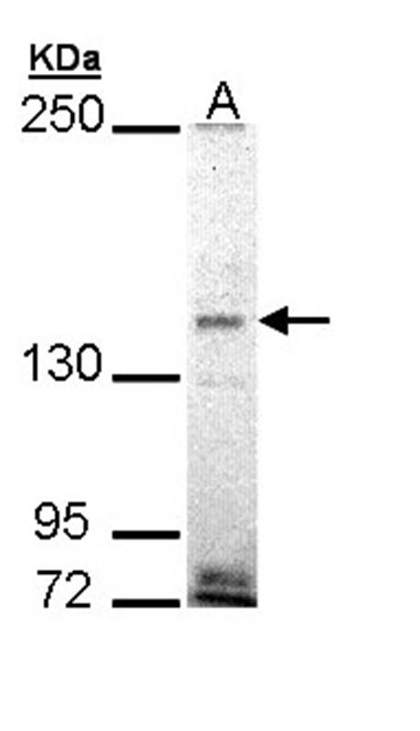 Anti-EHBP1 Antibody