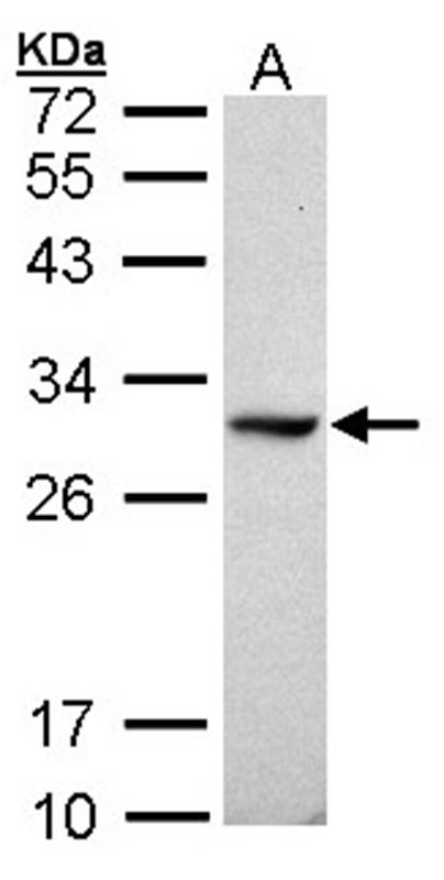 Anti-DDAH1 Antibody