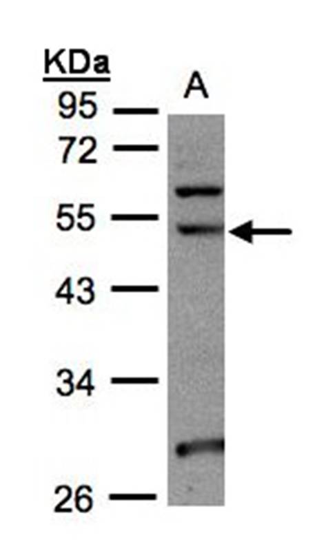 Anti-NSUN6 Antibody