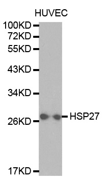 Anti-HSPB1 Antibody