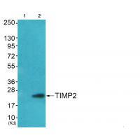 Anti-TIMP2 Antibody Anti-TIMP2 Antibody