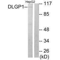 Anti-DLGP1 Antibody
