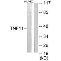 Anti-TNF11 Antibody